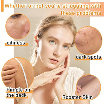 Turmeric Soap - Backdrop BlissTurmeric Soap