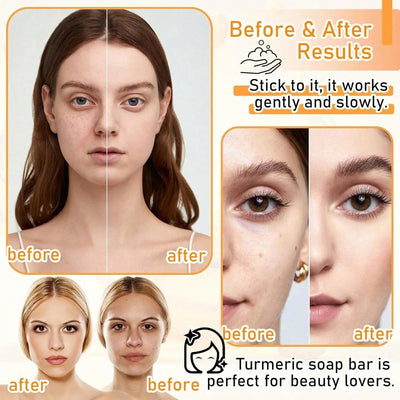 Turmeric Soap - Backdrop BlissTurmeric Soap